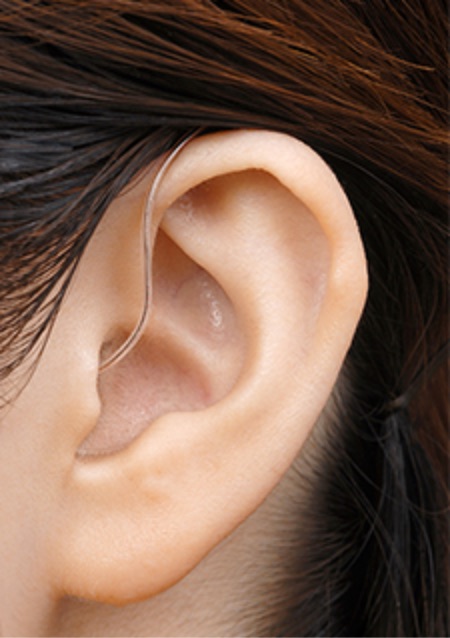 耳かけ型（RIC）
